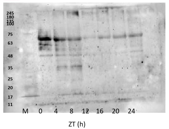 western blot using anti-GAI antibodies